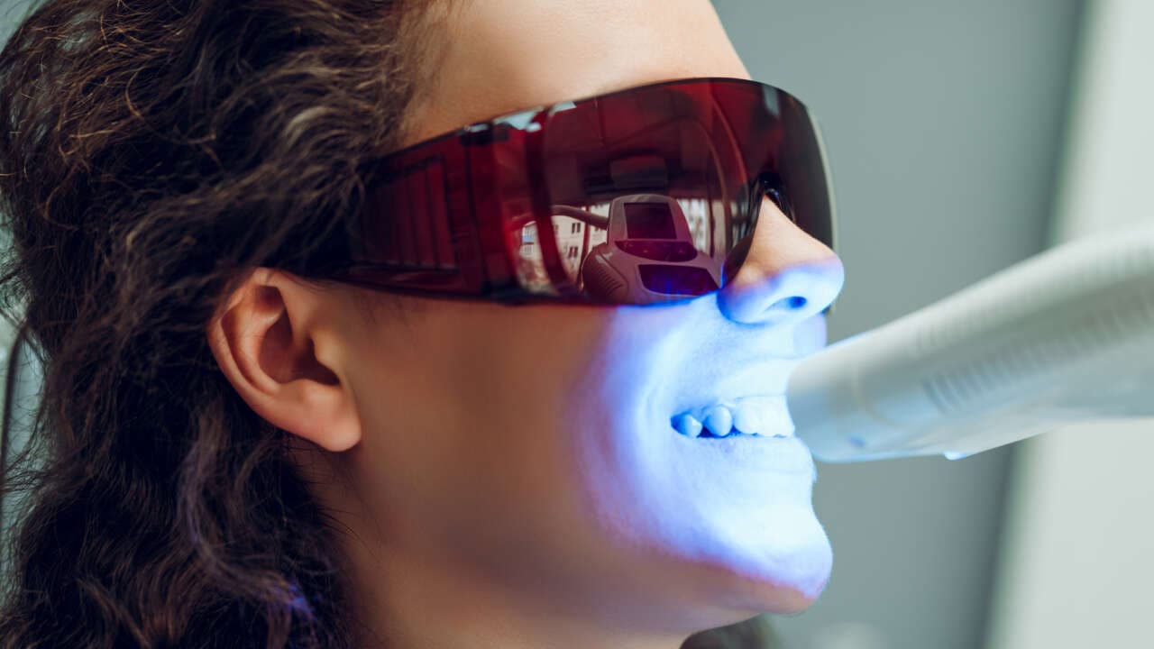 Teeth Whitening