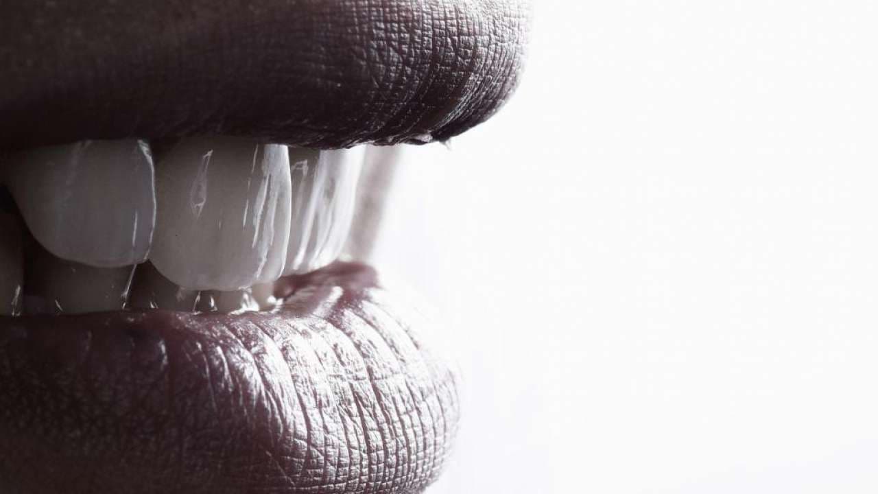 The Benefits of Dental Veneers