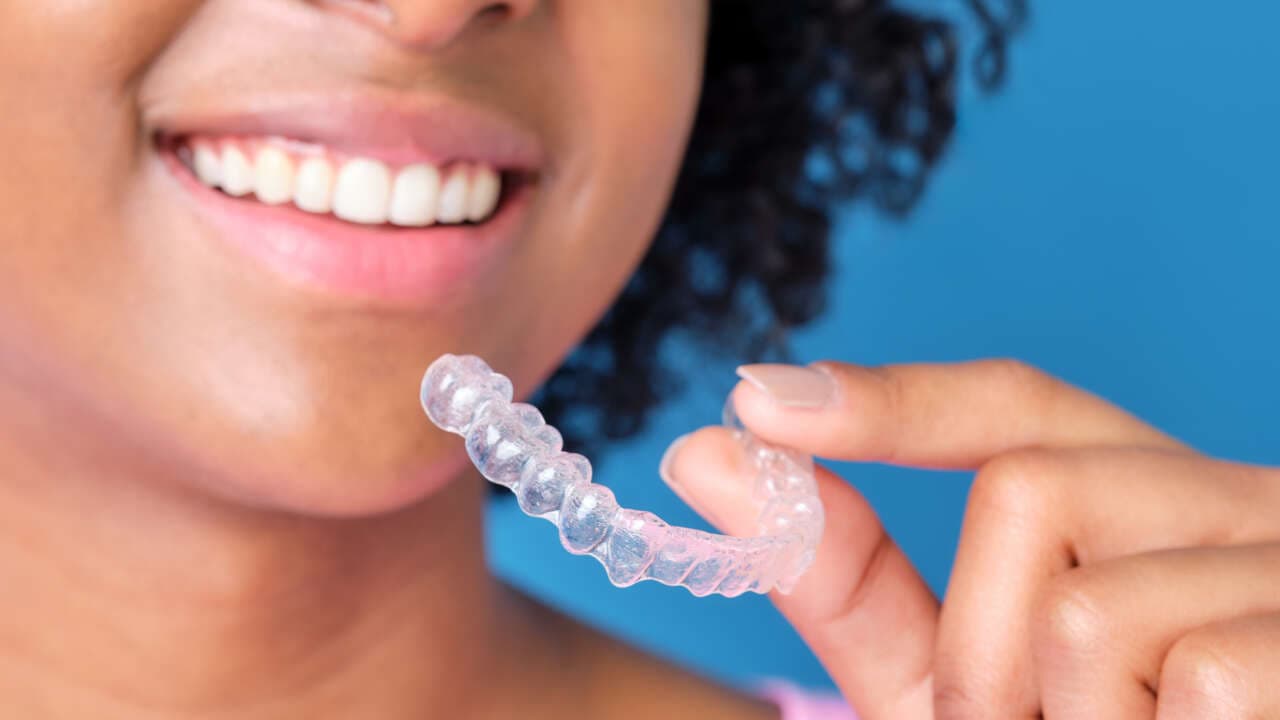 Tru-Smile Aligners