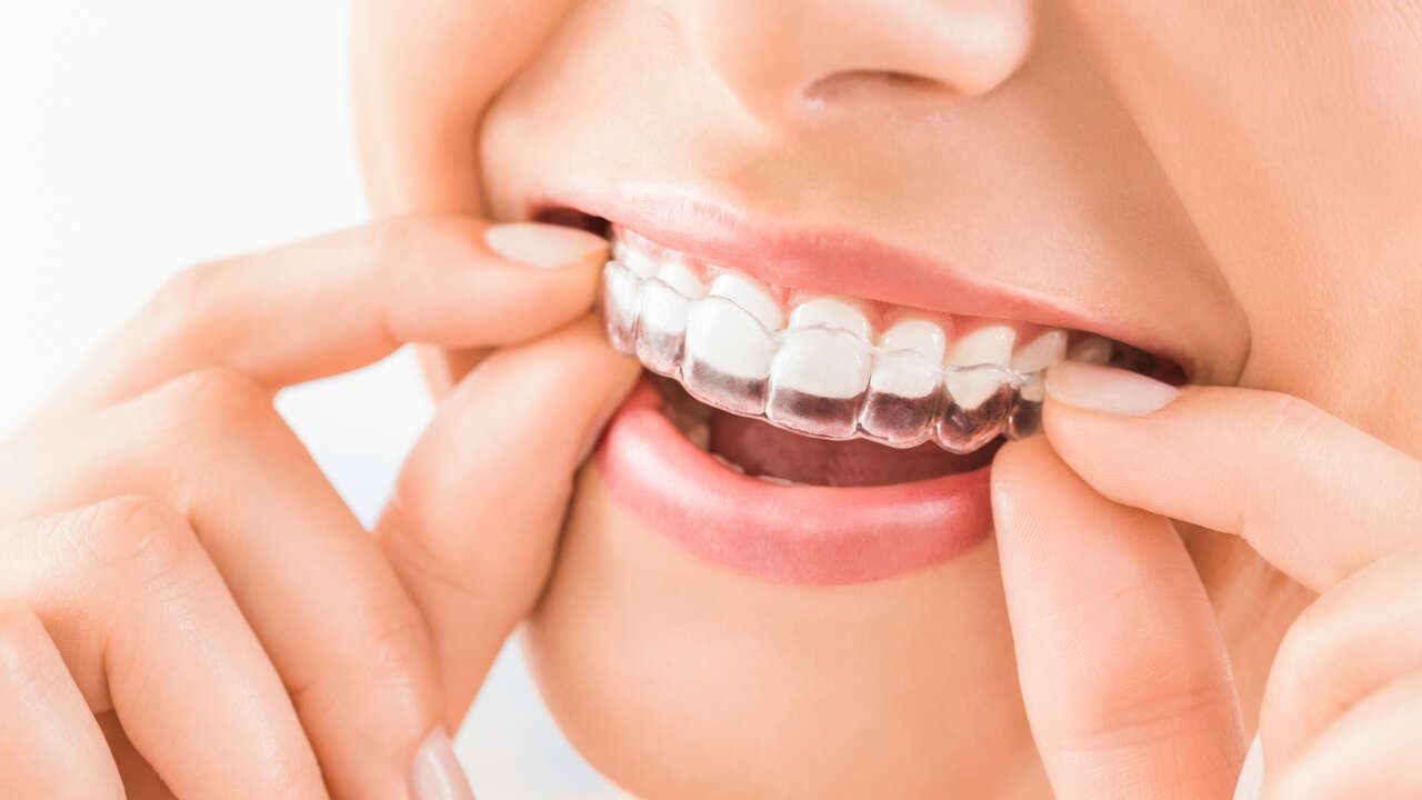 Invisalign®