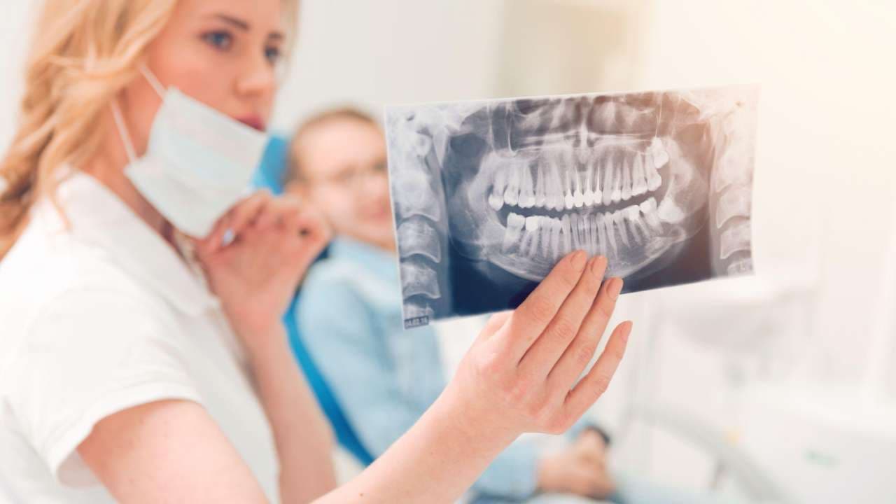 What to Expect from Wisdom Teeth Removal
